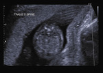 Small 31 opt