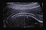 Small 32 opt