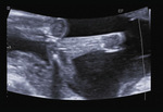 Small 33 opt