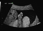 Small 35 opt