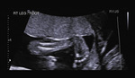 Small 36 opt