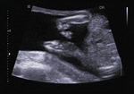 Small 37 opt