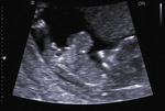 Small 5 opt