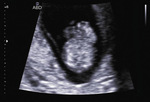 Small 6 opt