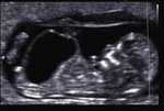 Small 7 opt