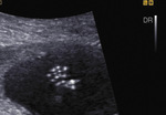 Small 8 opt