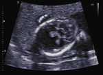 Small 9 opt