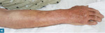 Small 10603