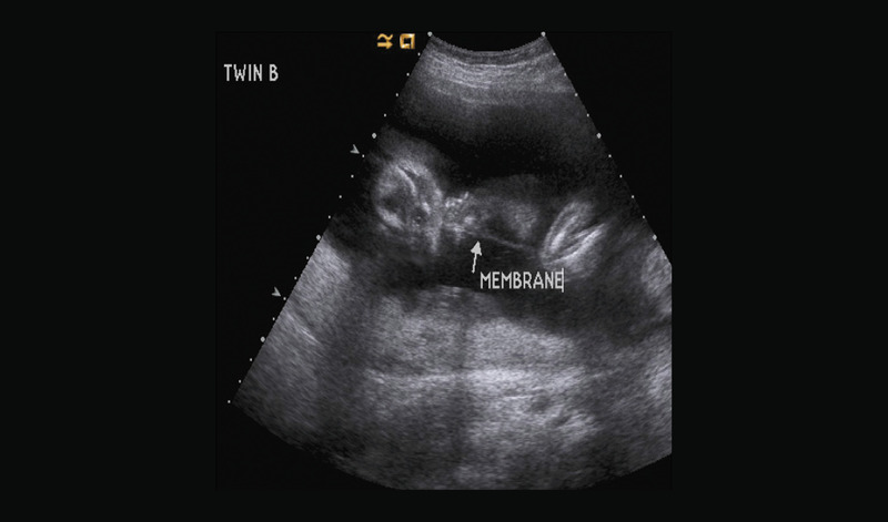 Medium 9c opt