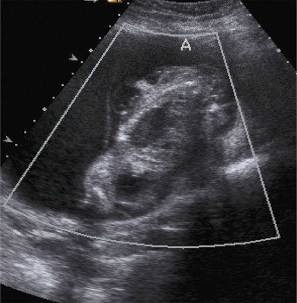 Medium 12a opt