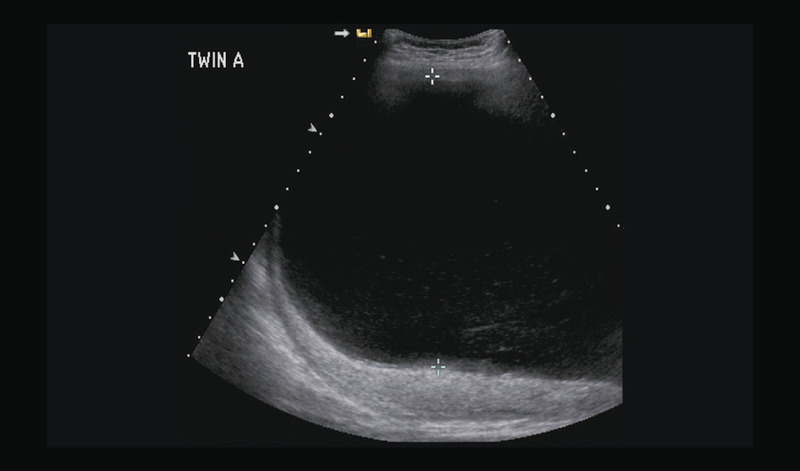 Medium 9a opt