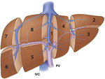 Small ryc 1 opt