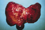 Small ryc 4 opt