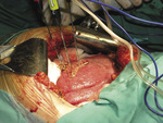 Small ryc 7 opt