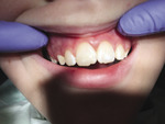 Small 03 opt