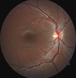 Small ryc 1 1 opt
