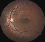 Small ryc 1 2 opt