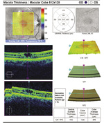 Small ryc 2 1 opt