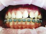 Small 01 opt