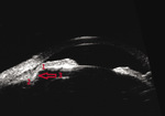 Small ryc 5 opt