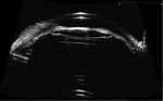 Small ryc 8 fmt
