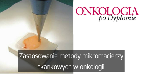 Fb artyku%c5%81 otwarty %2828%29