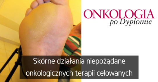 Fb artyku%c5%81 otwarty %2838%29